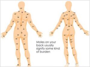 Mơ thấy nốt ruồi đánh số mấy